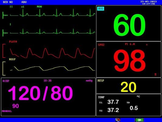 Oplaadbare batterij Draagbare patiëntmonitor Compact en lichtgewicht